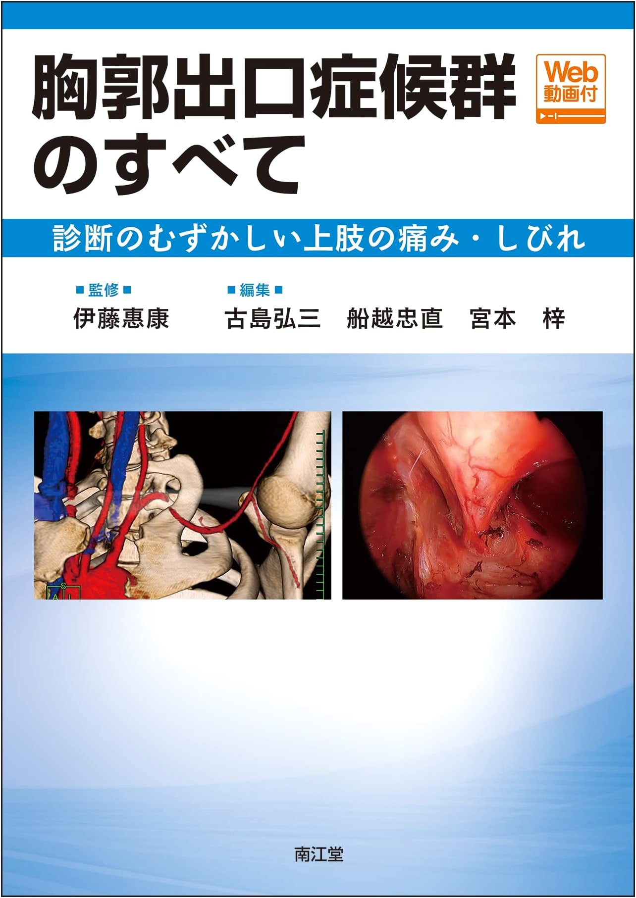 Thoracic Outlet Syndrome: Diagnosis of Difficult Upper Limb Pain & Numbness [with Web Video]
