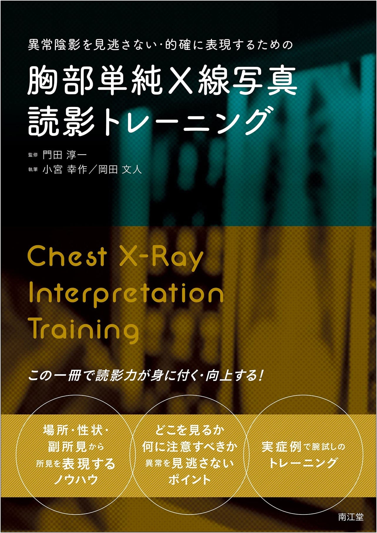 Chest X-ray Interpretation Training: Detecting & Accurately Describing Abnormalities