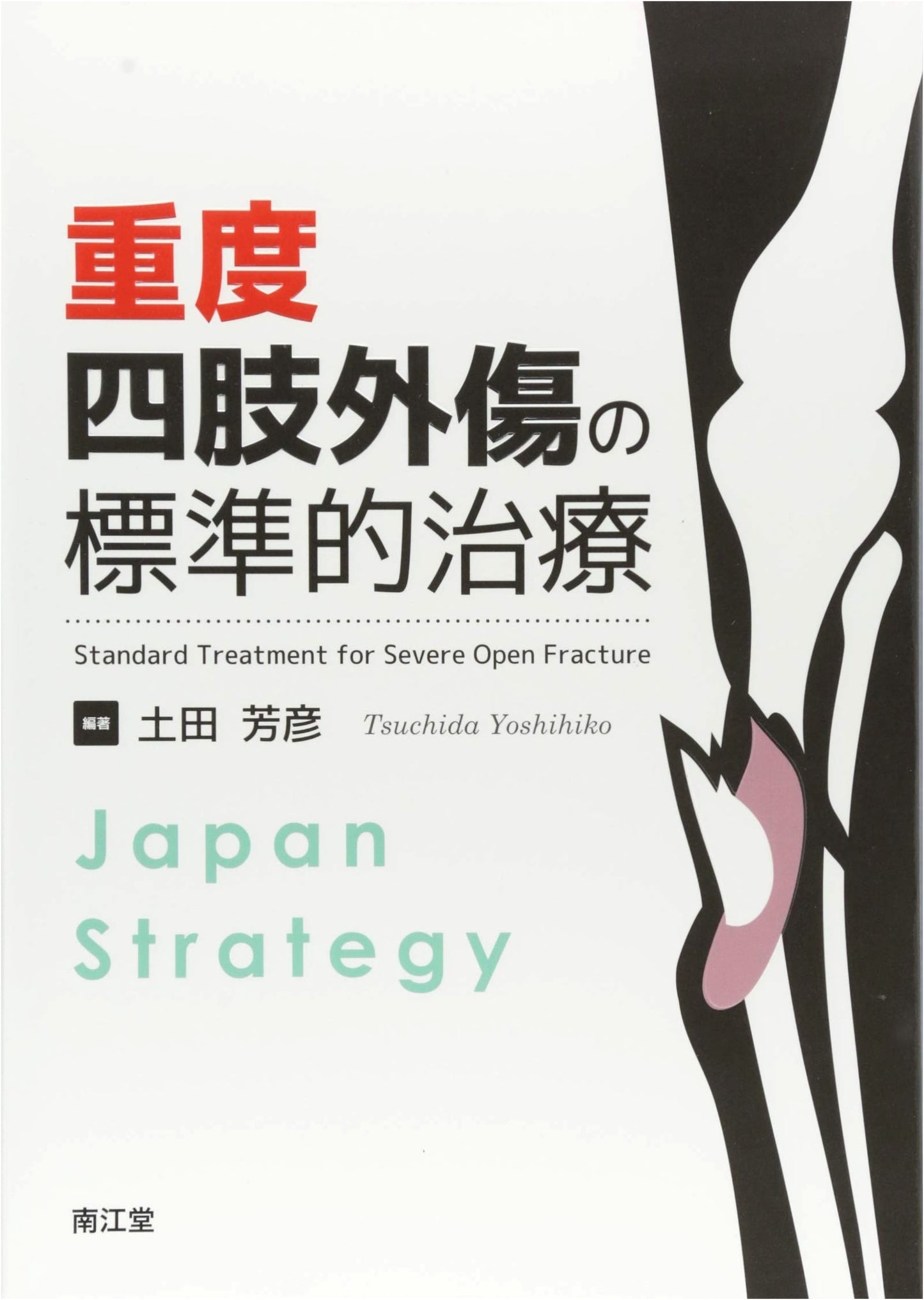 Standard Treatment for Severe Limb Trauma