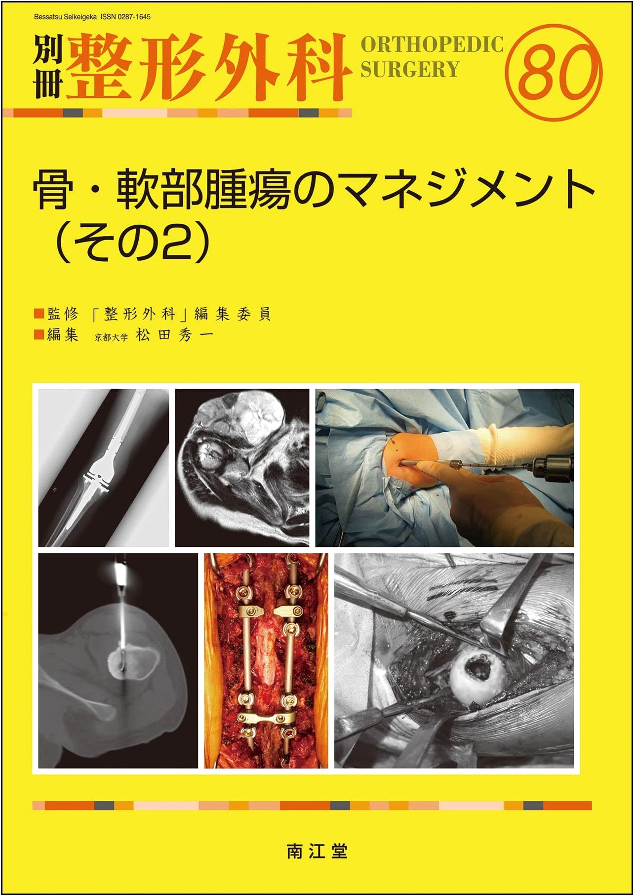 Management of Bone and Soft Tissue Tumors (Part 2) - Bessatsu Seikeigeka No. 80