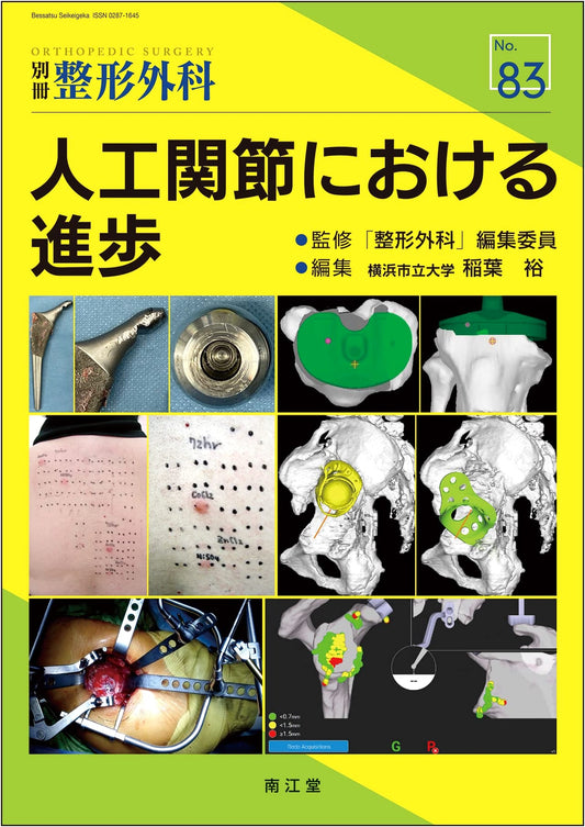 Advances in Artificial Joints (Orthopedics Supplement)