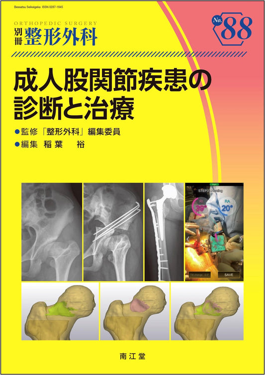 Diagnosis and Treatment of Adult Hip Joint Diseases (Orthopedic Surgery Special Issue No. 88)