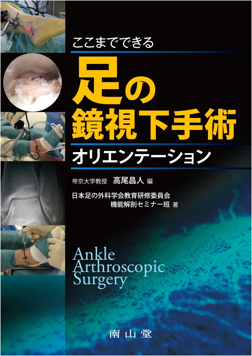 Comprehensive Orientation to Foot Arthroscopic Surgery