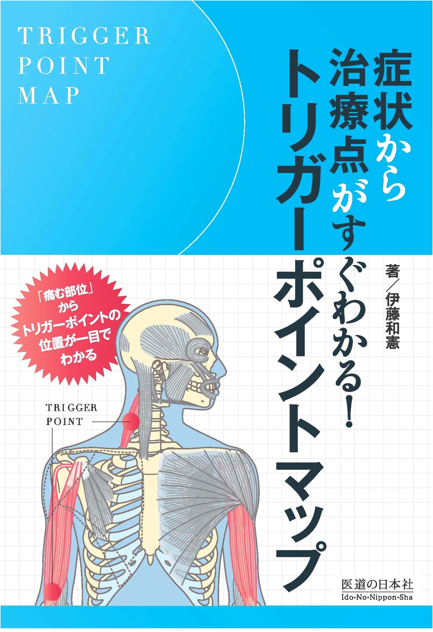 Trigger Point Map: Instant Reference for Symptom-Based Treatment