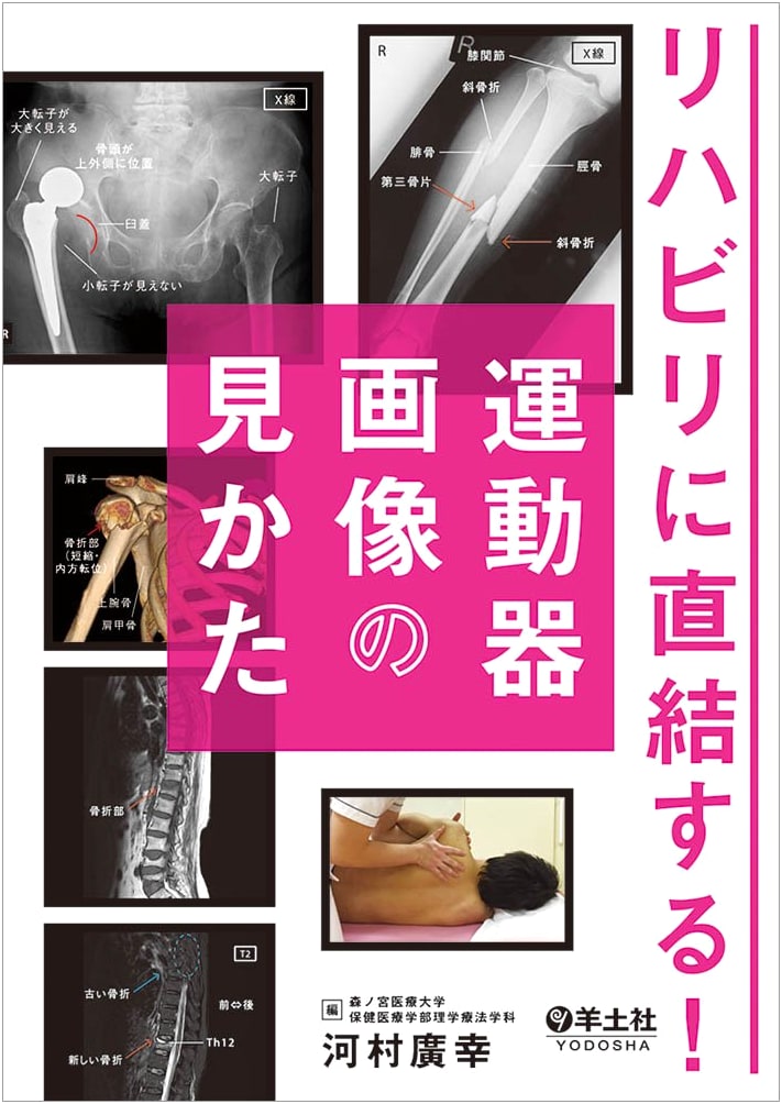 Directly Connected to Rehabilitation! How to View Musculoskeletal Images