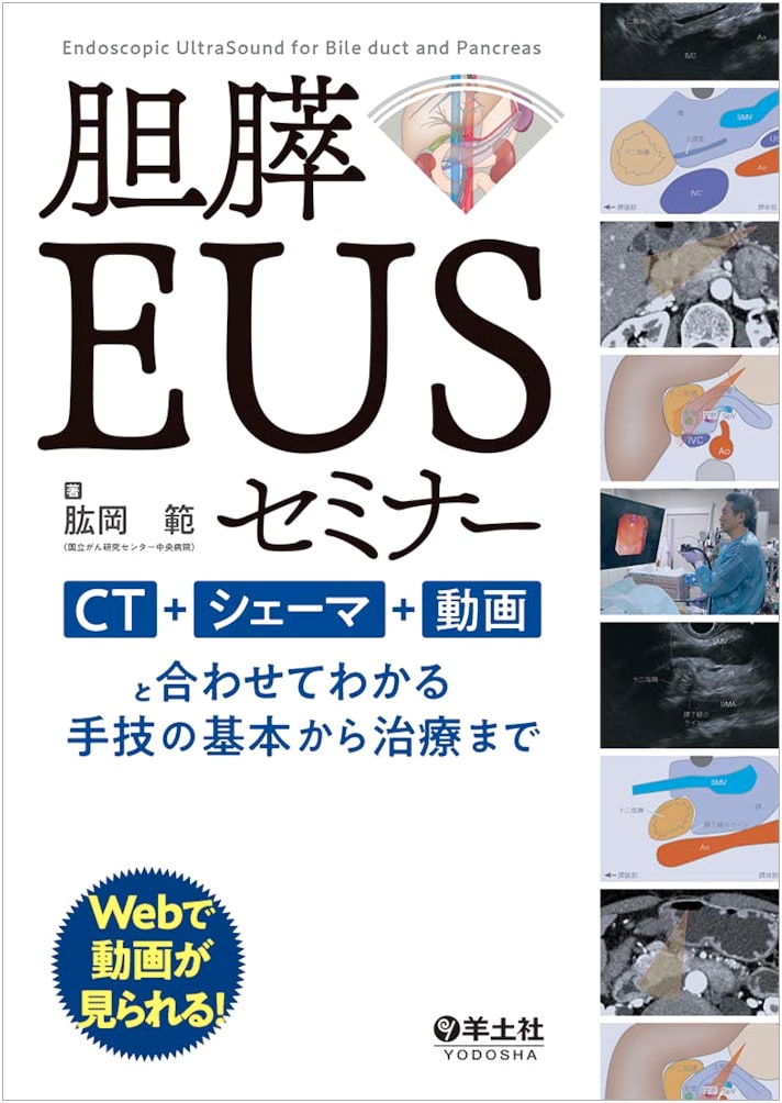 Biliary-Pancreatic EUS Seminar: From Basic Techniques to Treatment with CT, Schematics, and Videos