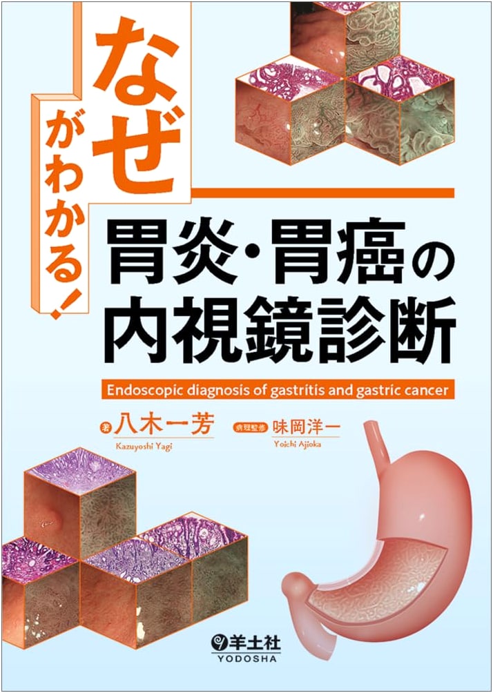 Understanding 'Why'! Endoscopic Diagnosis of Gastritis and Gastric Cancer
