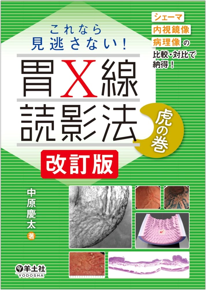 Gastric X-Ray Interpretation: Revised Master's Guide - Schema, Endoscopy & Pathology