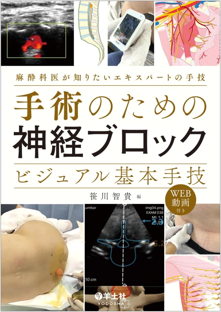 Nerve Blocks for Surgery: Visual Basic Techniques - Expert Procedures for Anesthesiologists