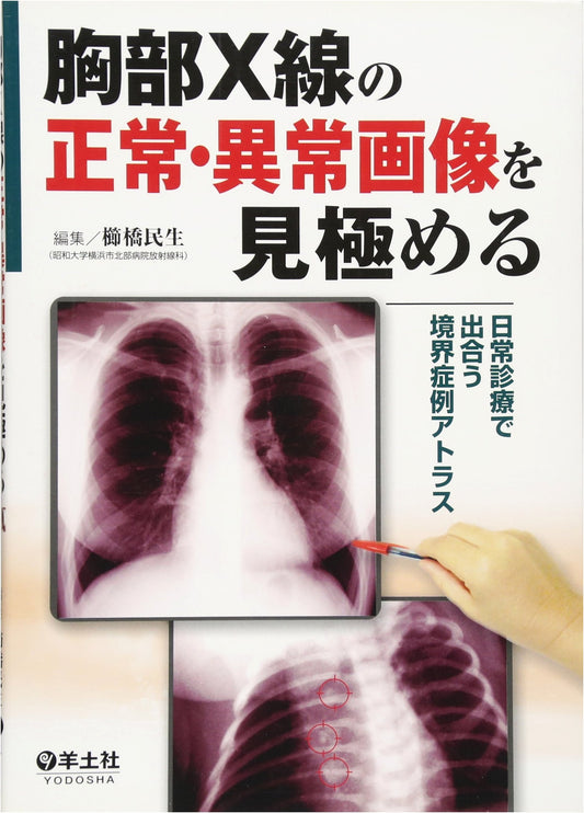 Atlas of Borderline Chest X-Ray Cases: Differentiating Normal & Abnormal Images