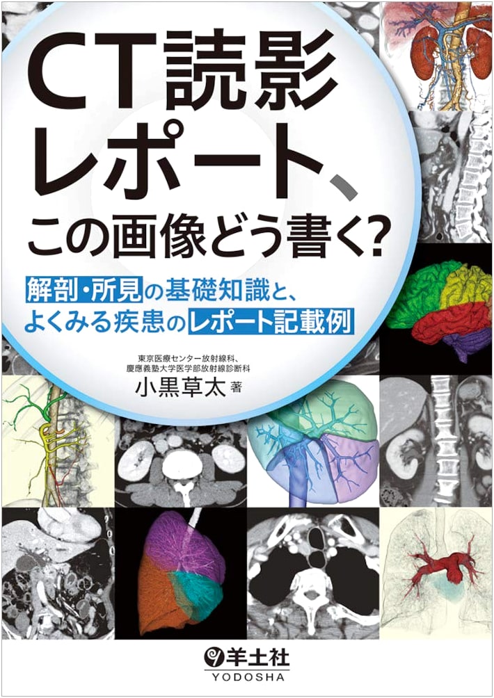 CT Scan Interpretation: Basic Anatomy, Findings, and Report Examples for Common Diseases