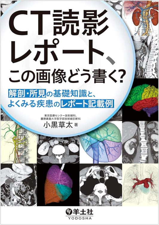 CT Scan Interpretation: Basic Anatomy, Findings, and Report Examples for Common Diseases