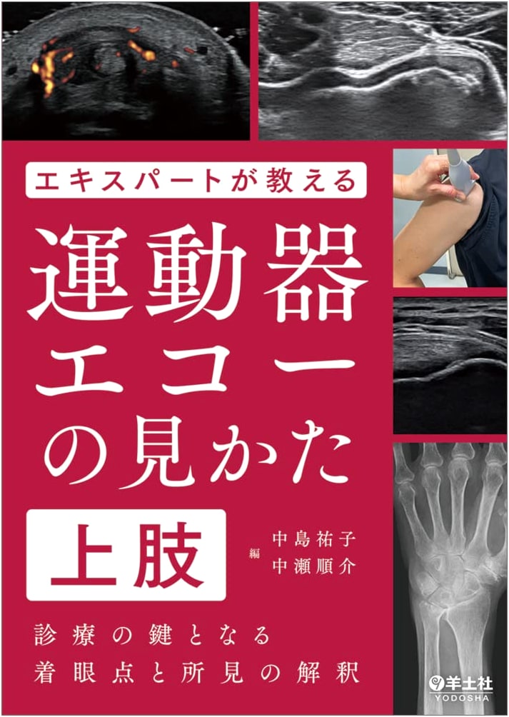 Expert Guide to Musculoskeletal Ultrasound: Upper Limbs - Key Clinical Insights