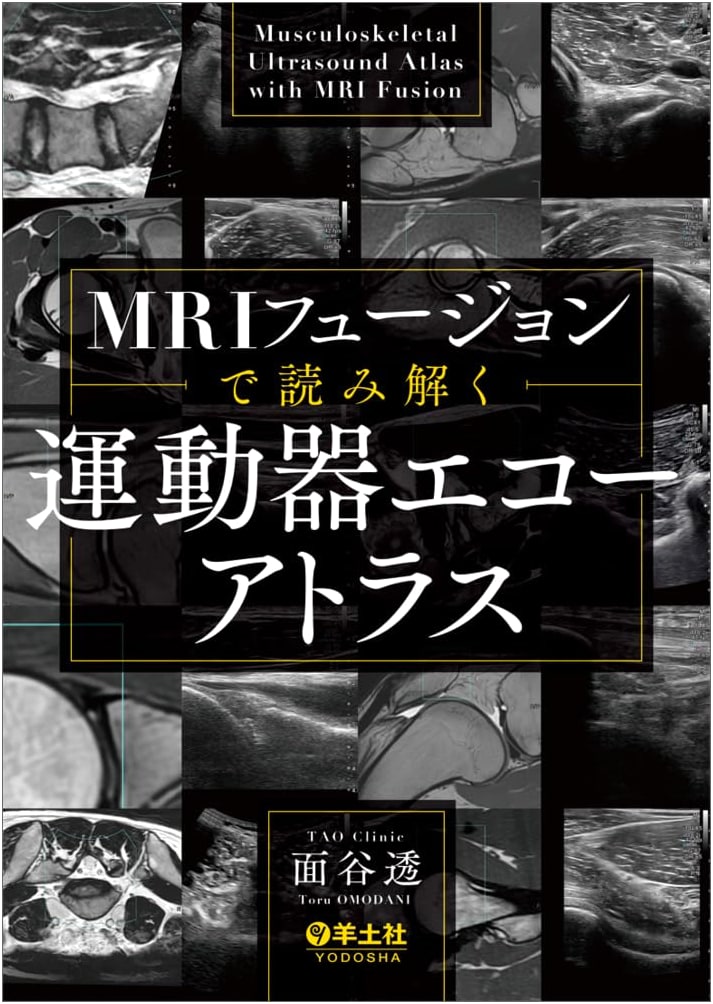 MRI Fusion Atlas: Interpreting Musculoskeletal Ultrasound by Toru Omotani