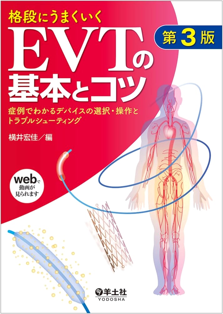 EVT Success Guide: Basics, Tips, Device Selection & Troubleshooting (3rd Ed)