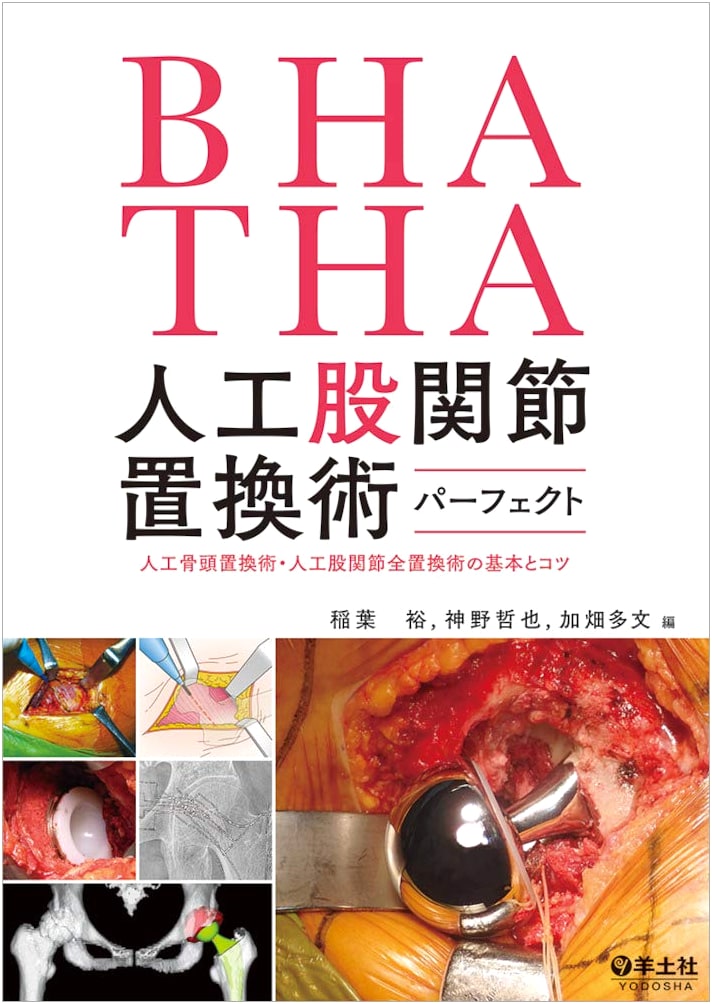 Complete Guide to BHA/THA Hip Replacement Surgery: Fundamentals & Tips for Hemiarthroplasty & Total Hip Arthroplasty