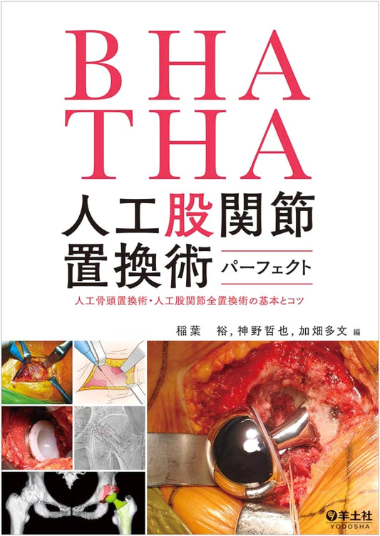 Complete Guide to BHA/THA Hip Replacement Surgery: Fundamentals & Tips for Hemiarthroplasty & Total Hip Arthroplasty