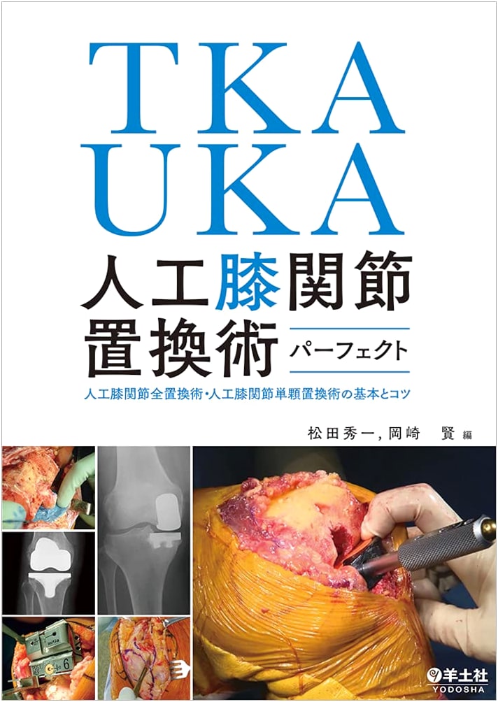 TKA/UKA Total Knee Arthroplasty: Fundamentals & Tips for Surgeons