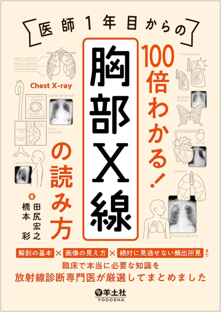 Chest X-Ray Interpretation: Essential Guide for First-Year Doctors. Anatomy, Imaging & Key Findings