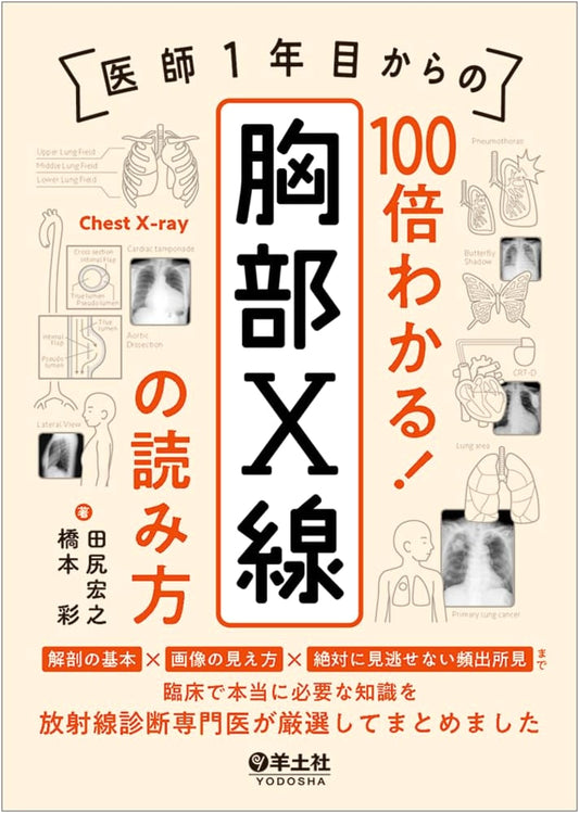 Chest X-Ray Interpretation: Essential Guide for First-Year Doctors. Anatomy, Imaging & Key Findings