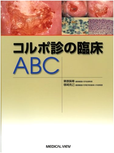 Colposcopy: A Clinical ABC by Misao Kurihara
