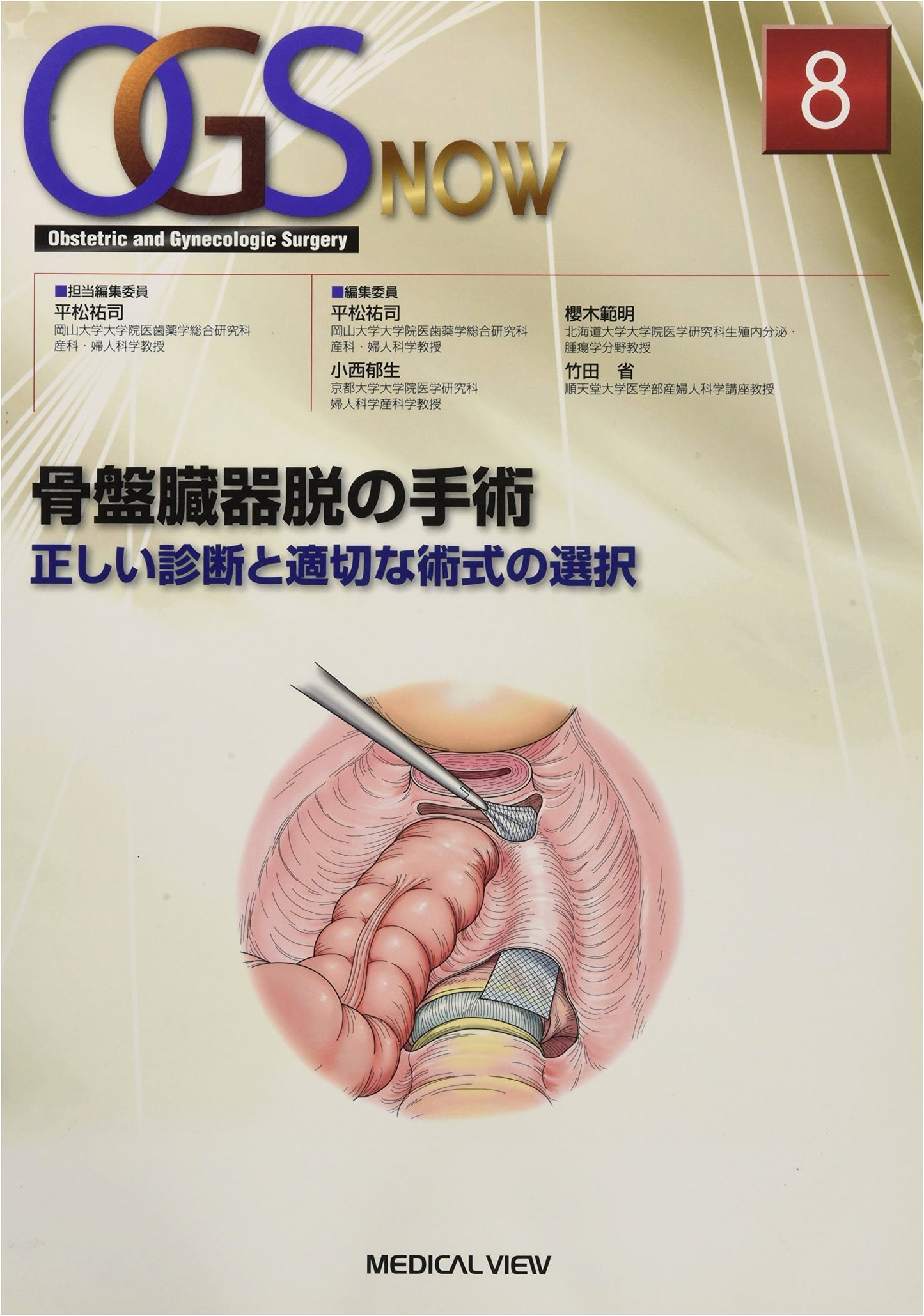 Pelvic Organ Prolapse Surgery: Accurate Diagnosis and Appropriate Procedure Selection