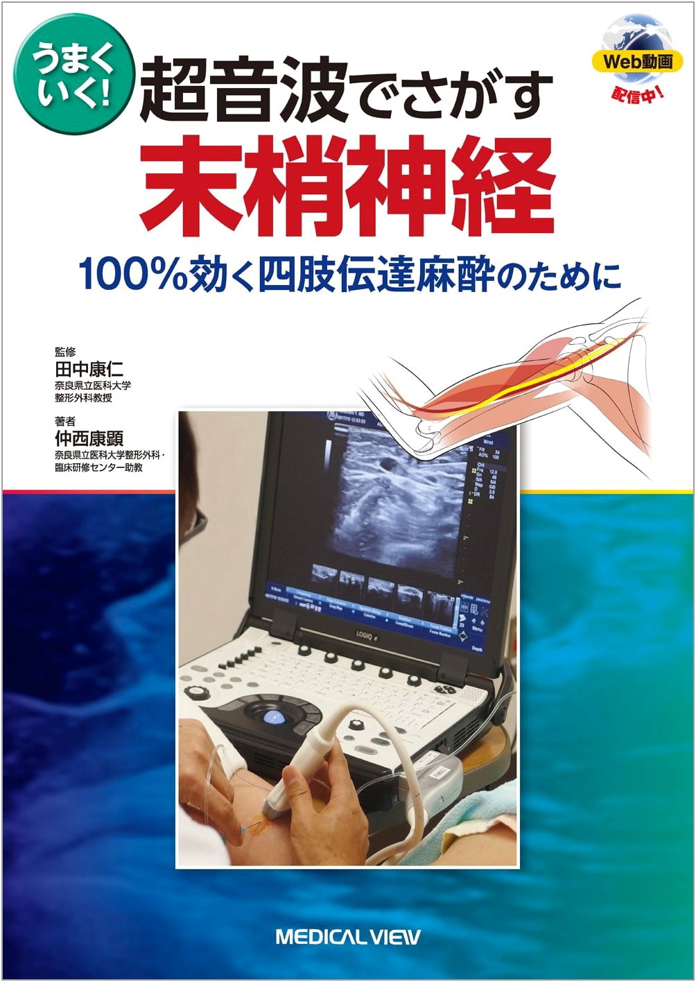 Ultrasound-Guided Peripheral Nerve Blocks: Ensuring 100% Effective Limb Anesthesia