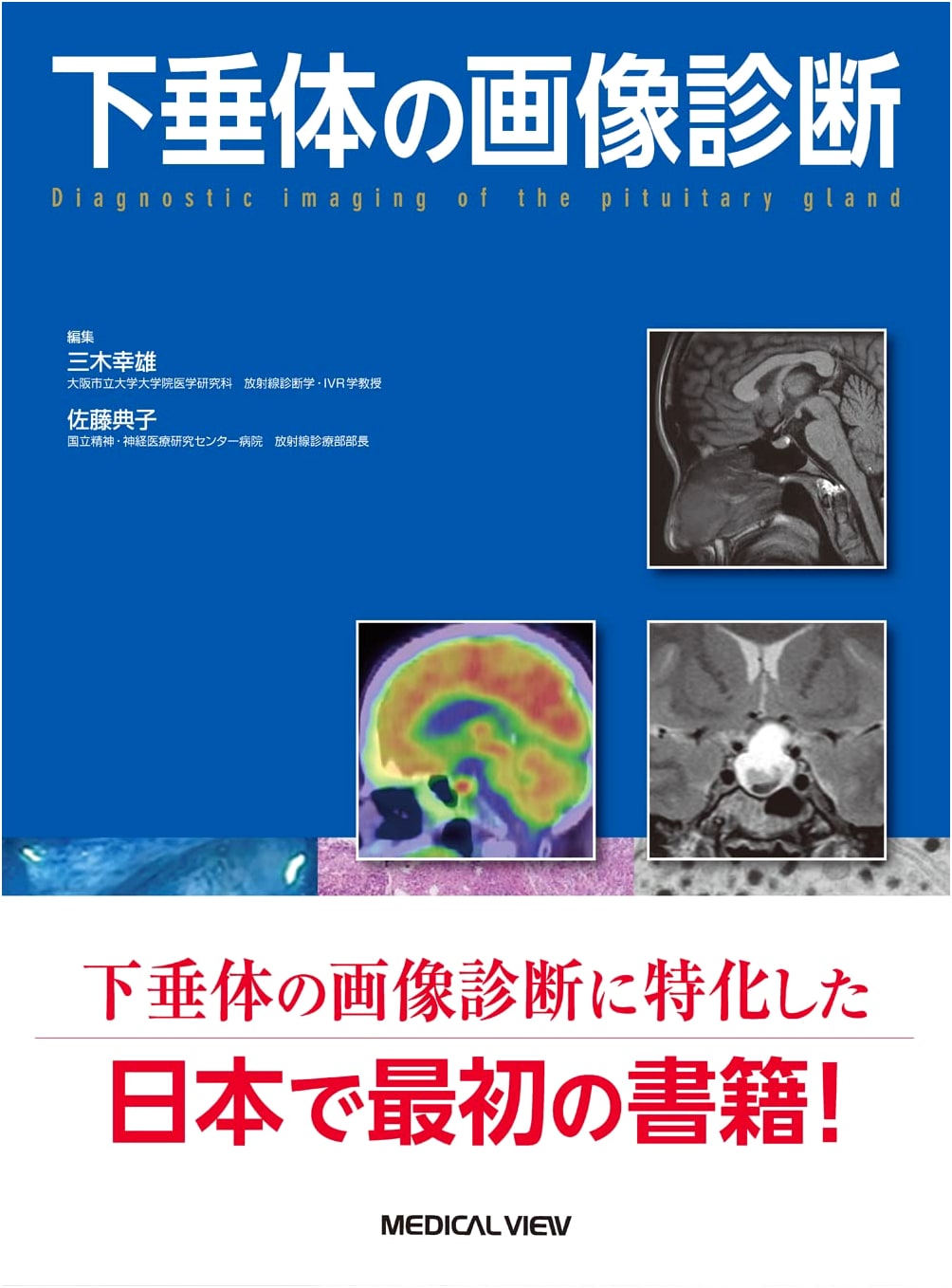 Imaging Diagnosis of the Pituitary Gland