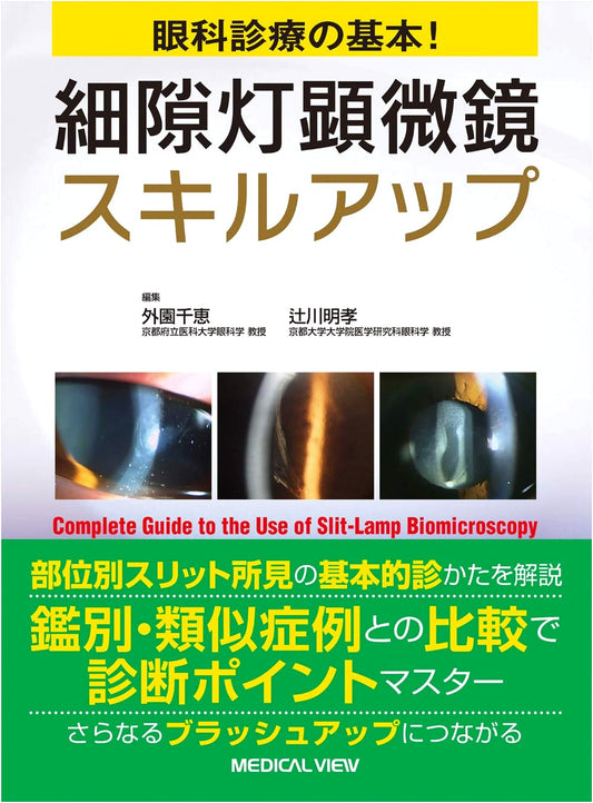 Essential Ophthalmic Practice: Mastering Slit Lamp Microscopy