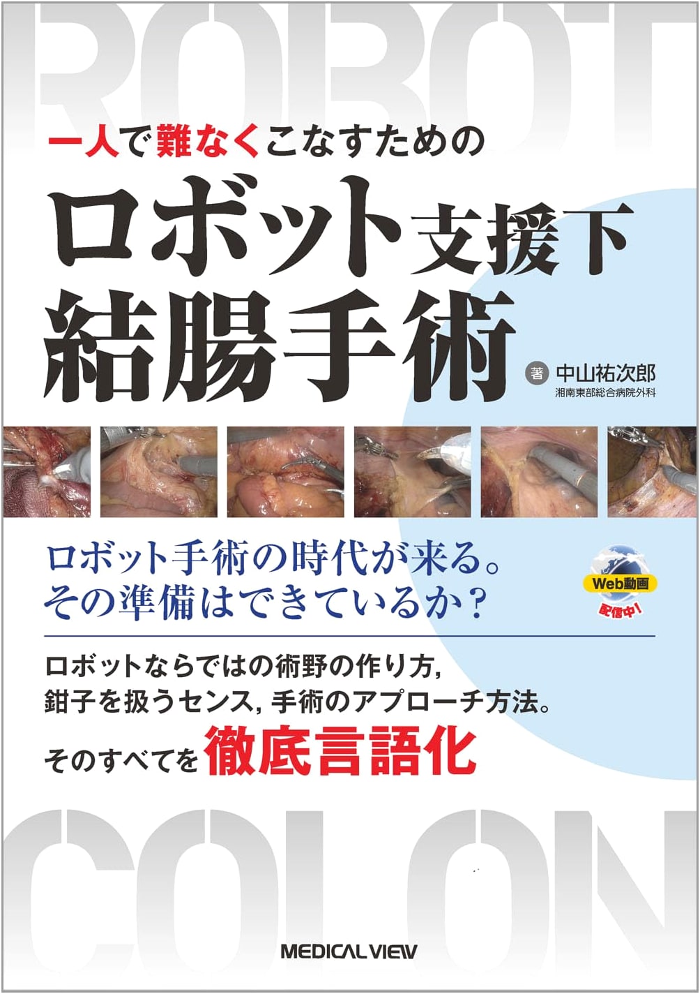 Robot-Assisted Colon Surgery: Mastering Solo Procedures [Includes Web Videos]