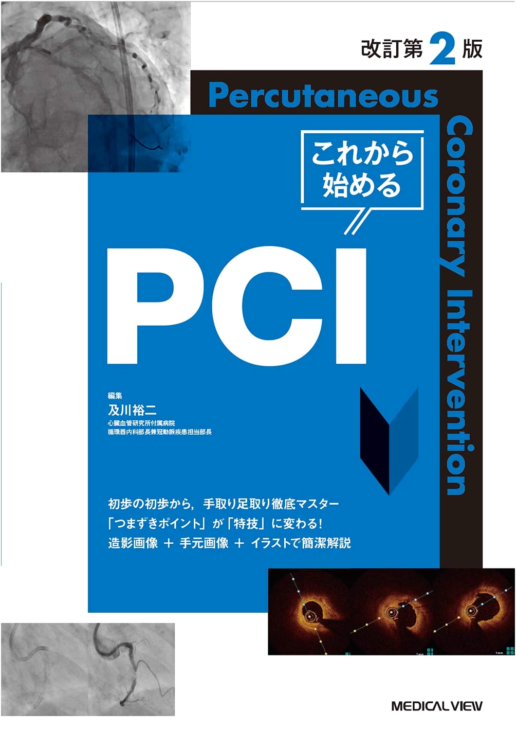 Starting PCI: Revised 2nd Edition