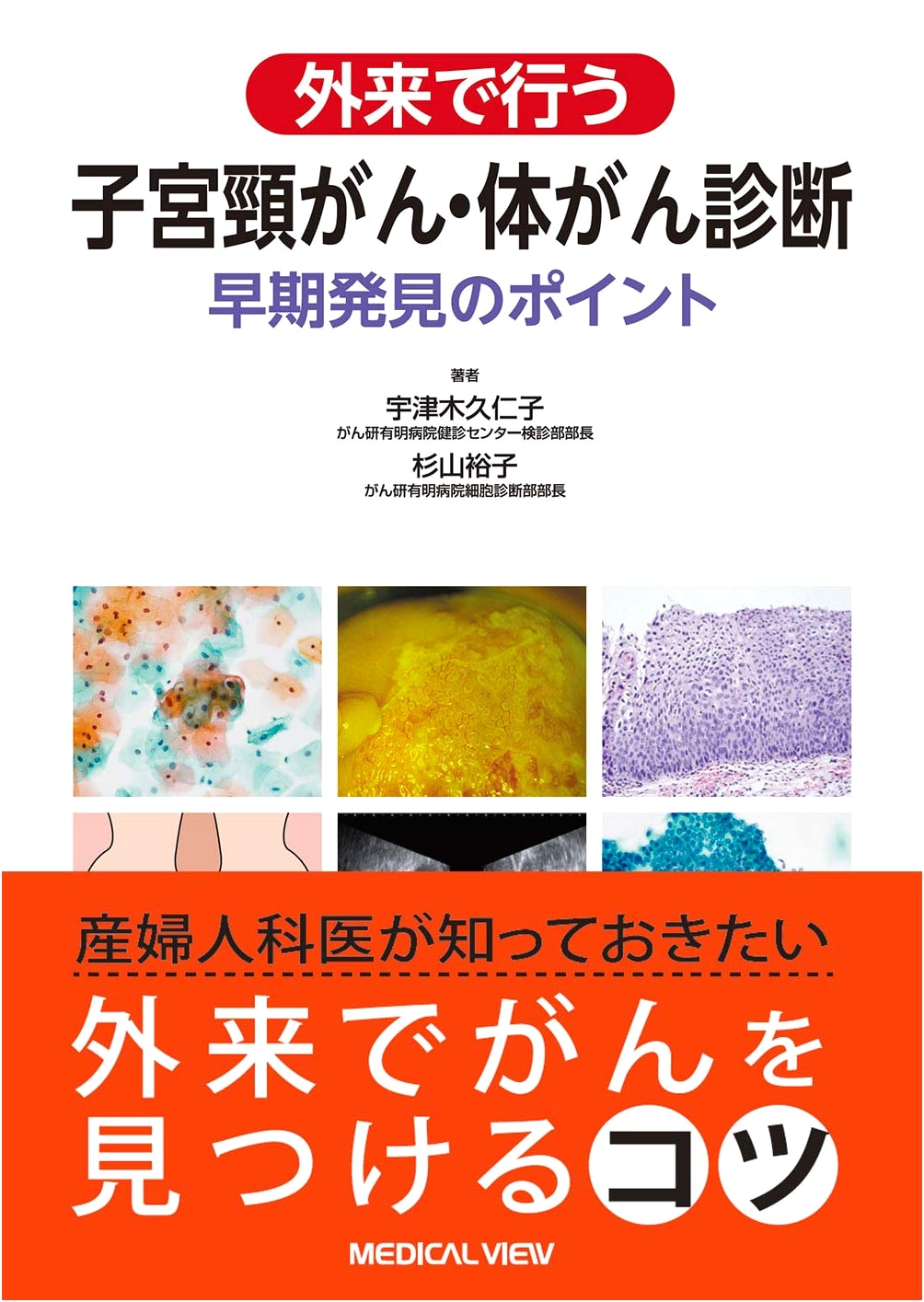 Outpatient Diagnosis of Cervical and Endometrial Cancer: Keys to Early Detection by Kuniko Utsugi