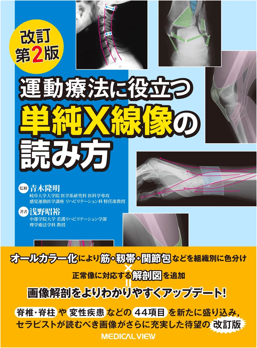 Interpreting X-ray Images for Exercise Therapy - Revised 2nd Edition