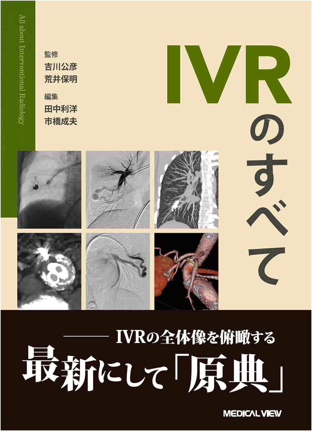 All About IVR: Interventional Radiology Explained