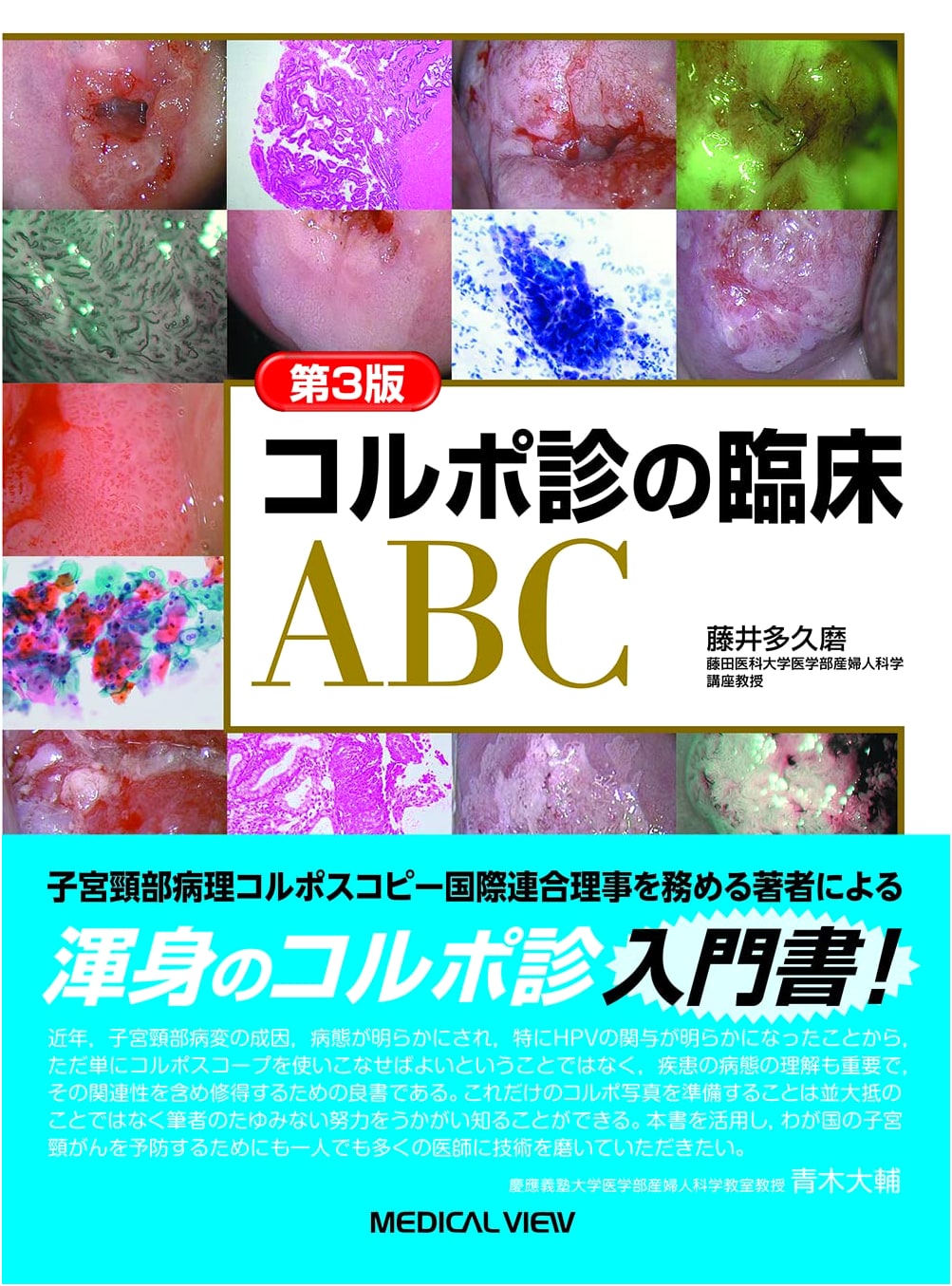 Colposcopy Clinical ABC - Third Edition, by Takuma Fujii