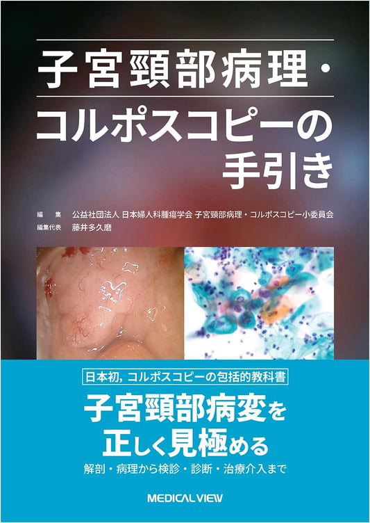 A Guide to Cervical Pathology and Colposcopy
