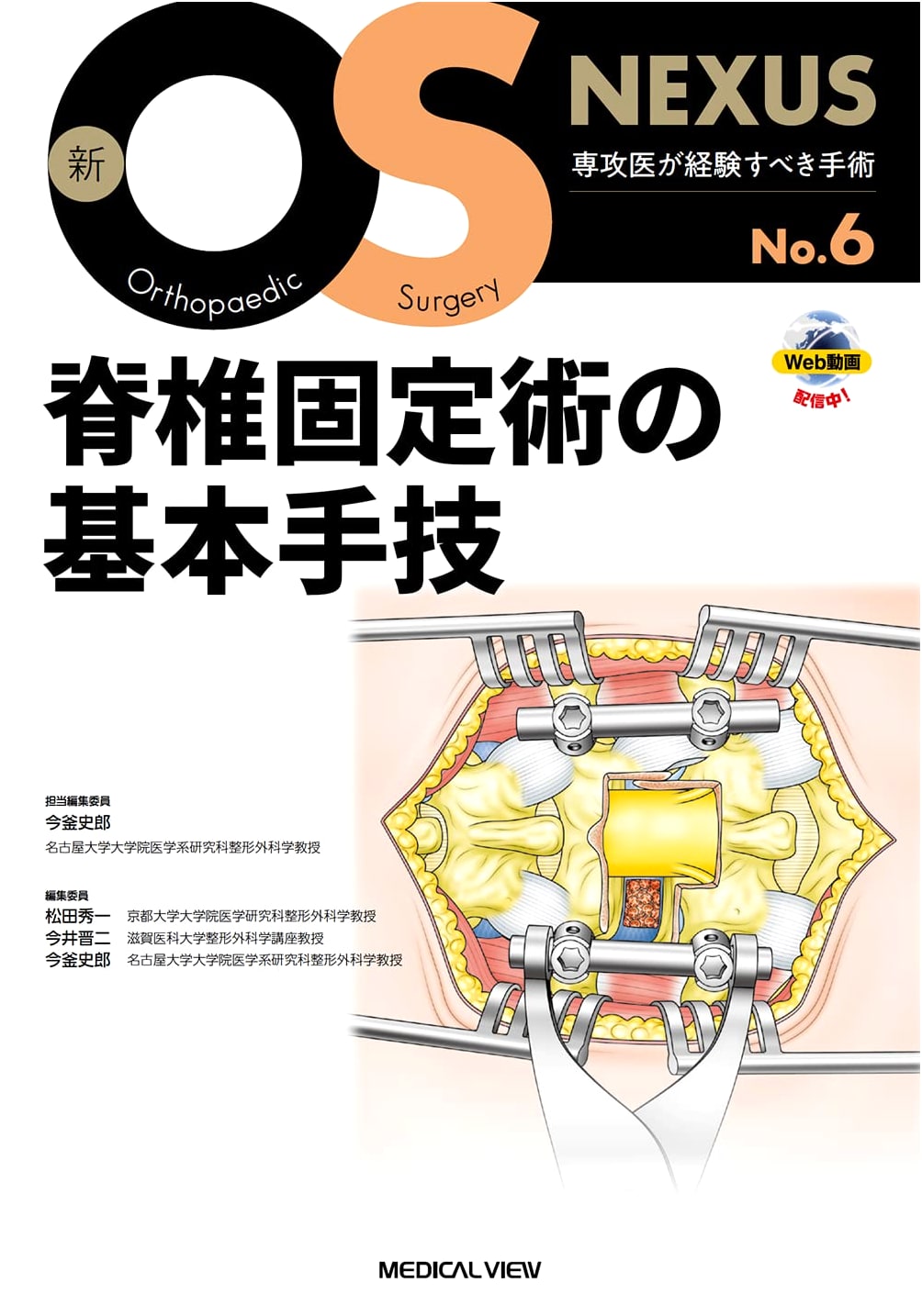 Basic Techniques of Spinal Fixation [with Web Videos] (New OS NEXUS No.6)