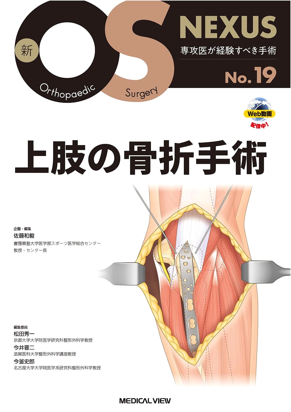 Upper Extremity Fracture Surgery (New OS NEXUS No.19)