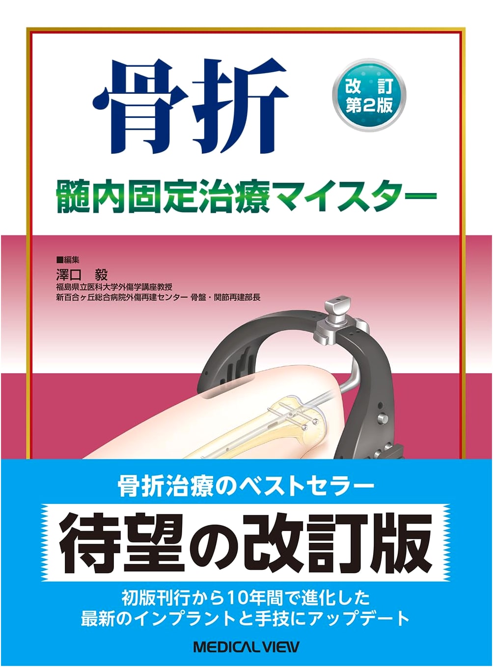 Revised 2nd Ed. Fracture Intramedullary Fixation Treatment Meister
