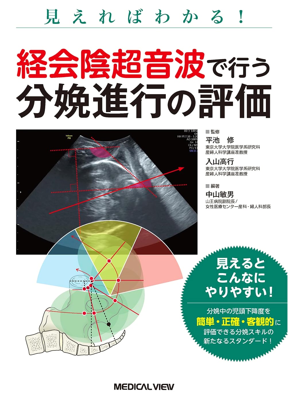 Visual Guide to Perineal Ultrasound for Labor Progress Assessment by Nakayama Toshio