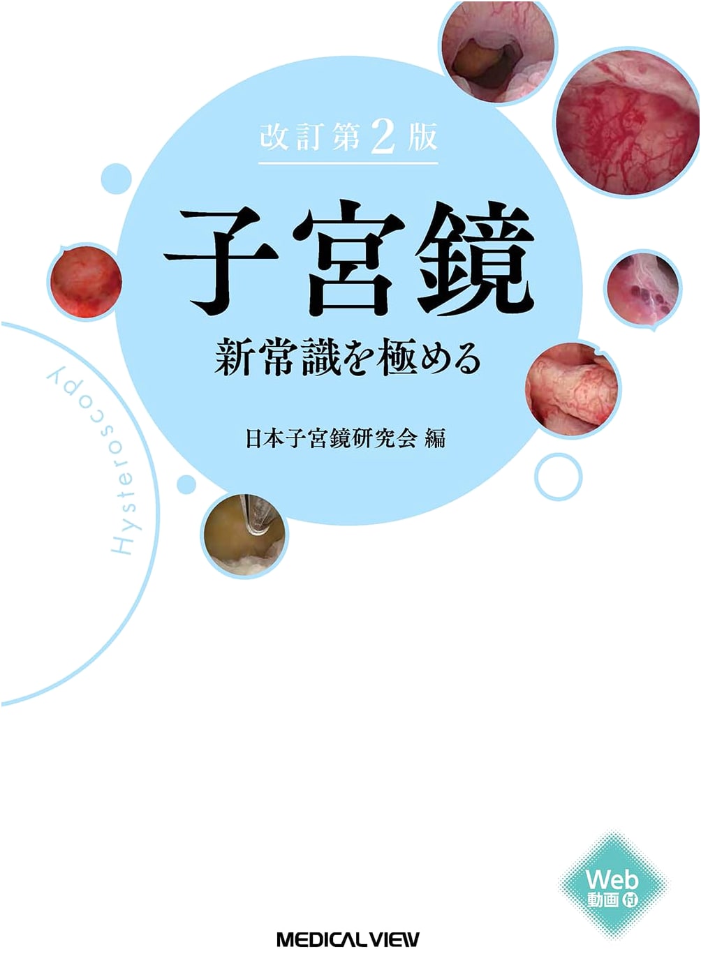 Hysteroscopy: Mastering New Common Knowledge - Revised 2nd Edition