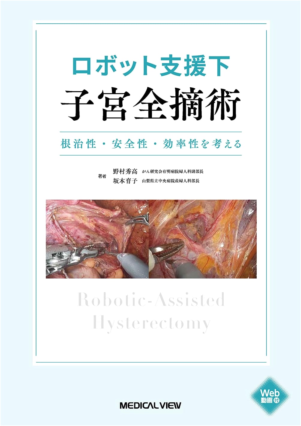 Robot-Assisted Total Hysterectomy: Considering Radicality, Safety, and Efficiency