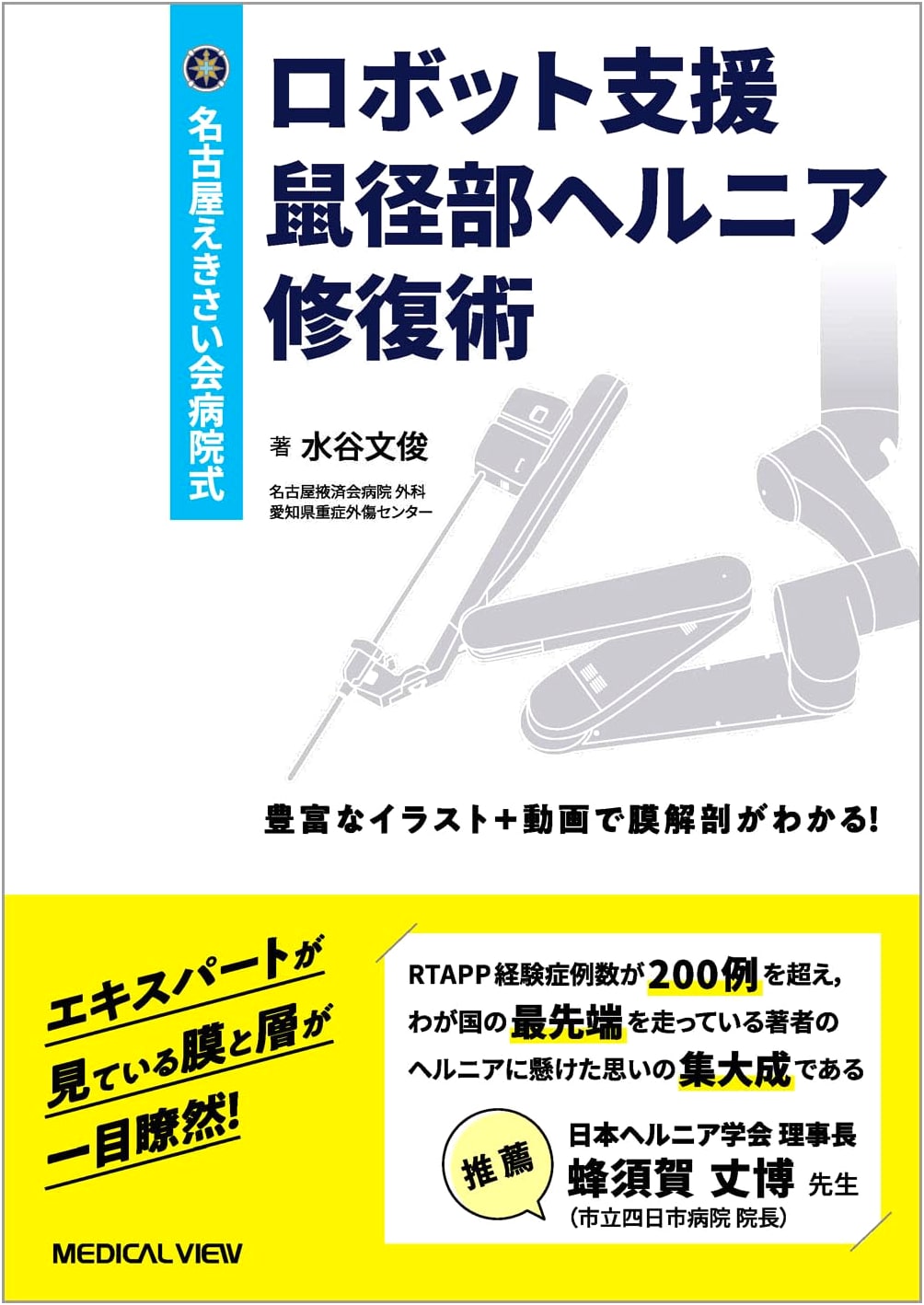 Nagoya Ekisaikai Hospital Method: Robot-Assisted Inguinal Hernia Repair [with Web Video]