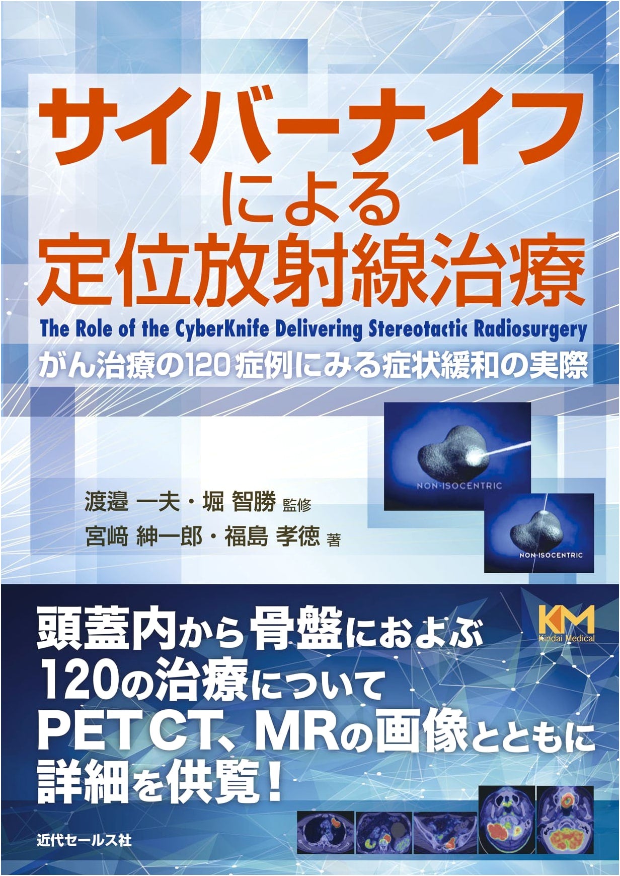 Cyberknife Stereotactic Radiotherapy: Symptom Relief in 120 Cancer Cases
