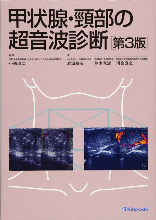Ultrasound Diagnosis of the Thyroid Gland and Neck