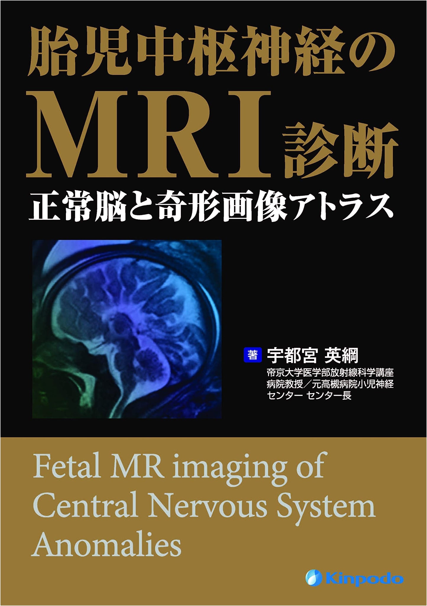 MRI Diagnosis of the Fetal Central Nervous System: Atlas of Normal Brain and Malformations by Hidetsuna Utsunomiya