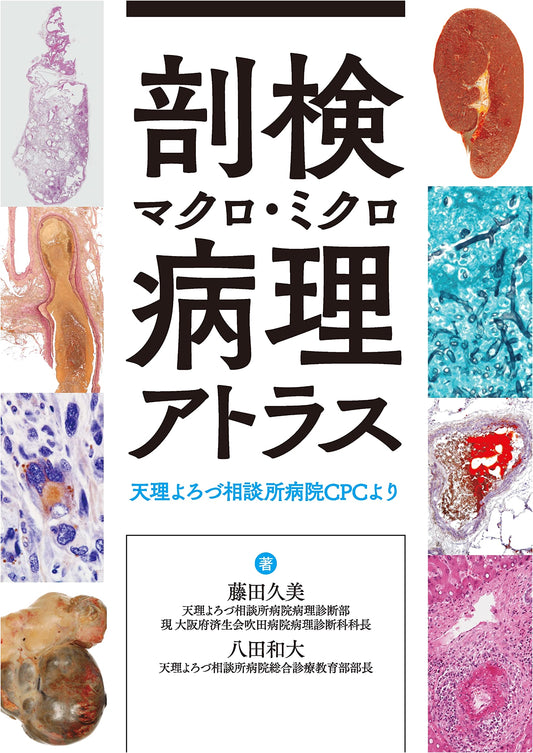 Autopsy Macro & Micro Pathology Atlas: Tenri Yorozu Sodansho Hospital CPC