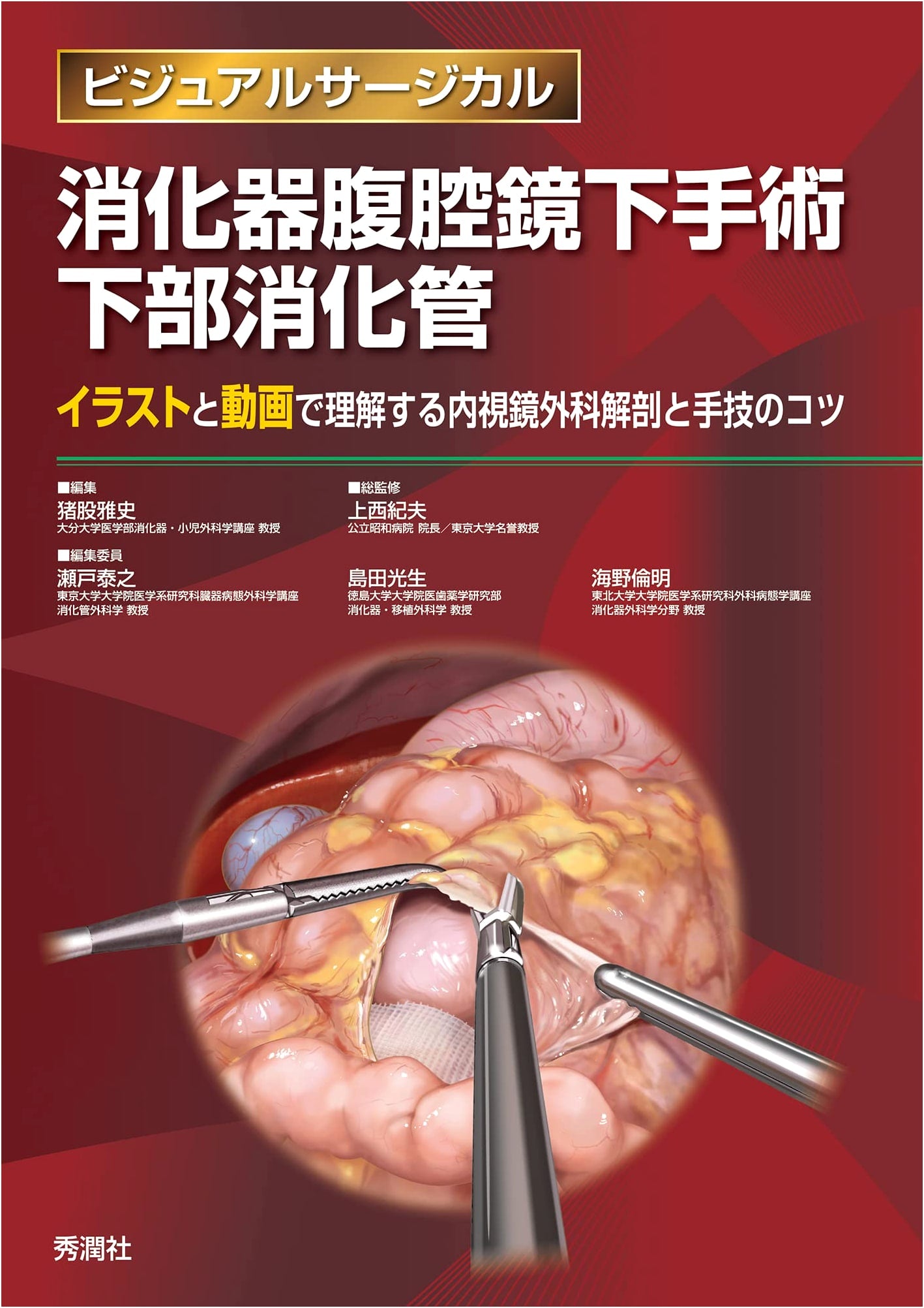 Digestive Laparoscopic Surgery: Lower Gastrointestinal Tract (Visual Surgical)