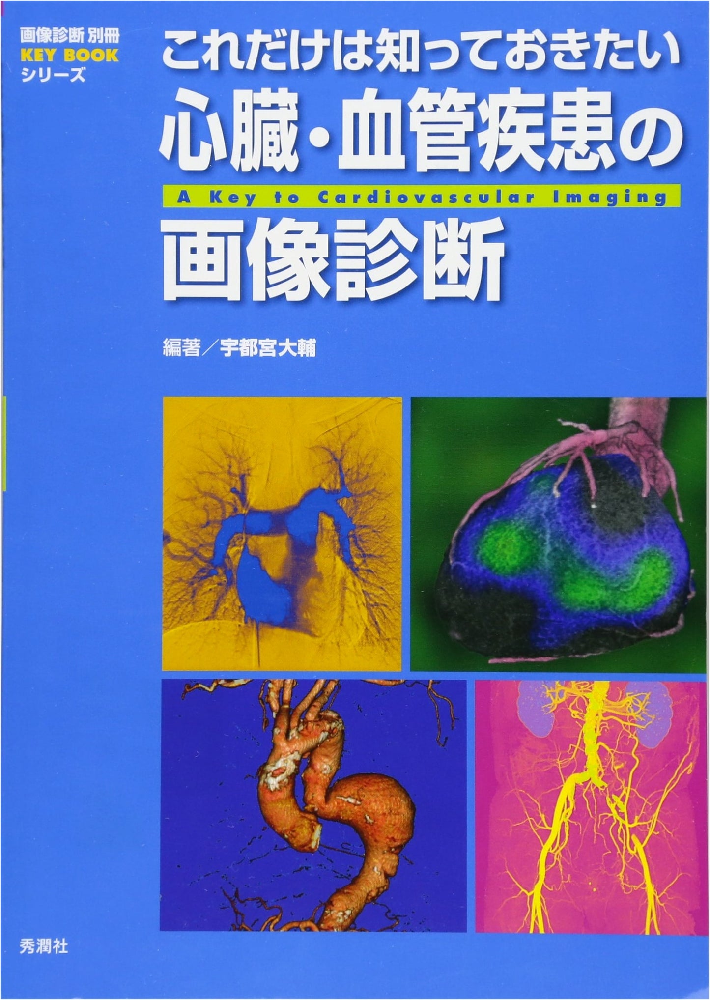 Essential Diagnostic Imaging for Cardiovascular Diseases (KEYBOOK Series)
