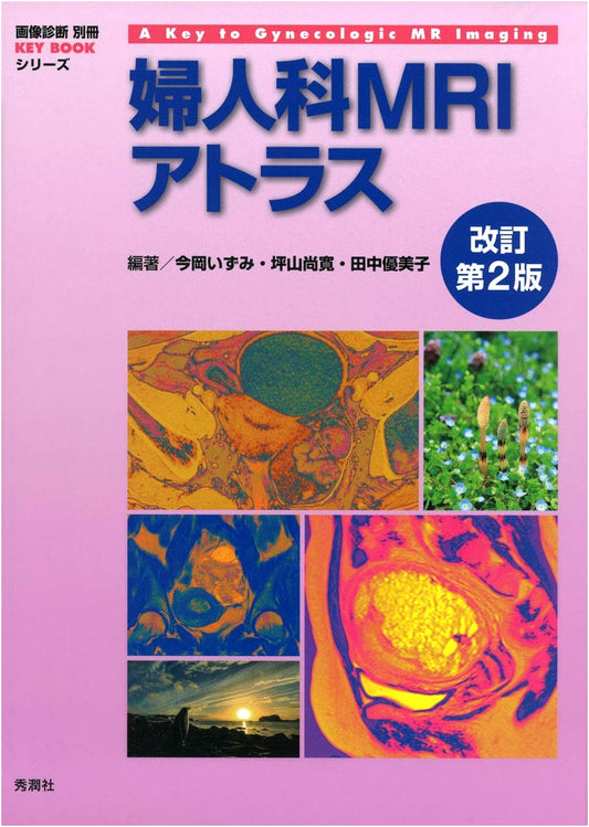 Atlas of Gynecologic MRI, Revised 2nd Edition by Izumi Imaoka